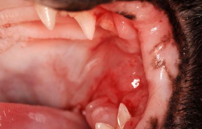 بیماری استوماتیت یا التهاب دهان چیست؟