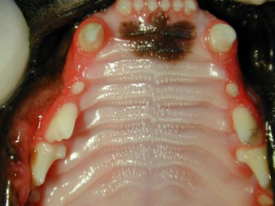 بیماری استوماتیت یا التهاب دهان چیست؟
